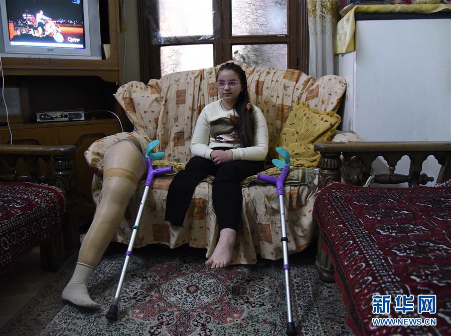 （國際&middot;圖文互動）（1）通訊：戰爭給他們留下殘缺的童年&mdash;&mdash;敘利亞危機9周年記